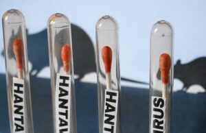 Is the Hantavirus in the U.S.? Update Amid 2026 Cruise Ship Chaos is-the-hantavirus-in-the-us.?-update-amid-2026-cruise-ship-chaos