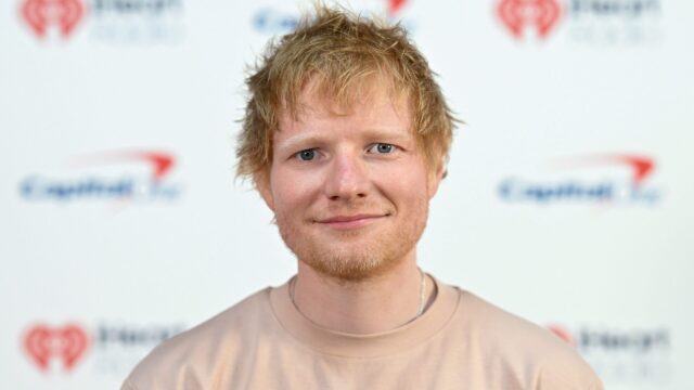ed-sheeran-reveals-shaved-head,-herpes-zoster-infection